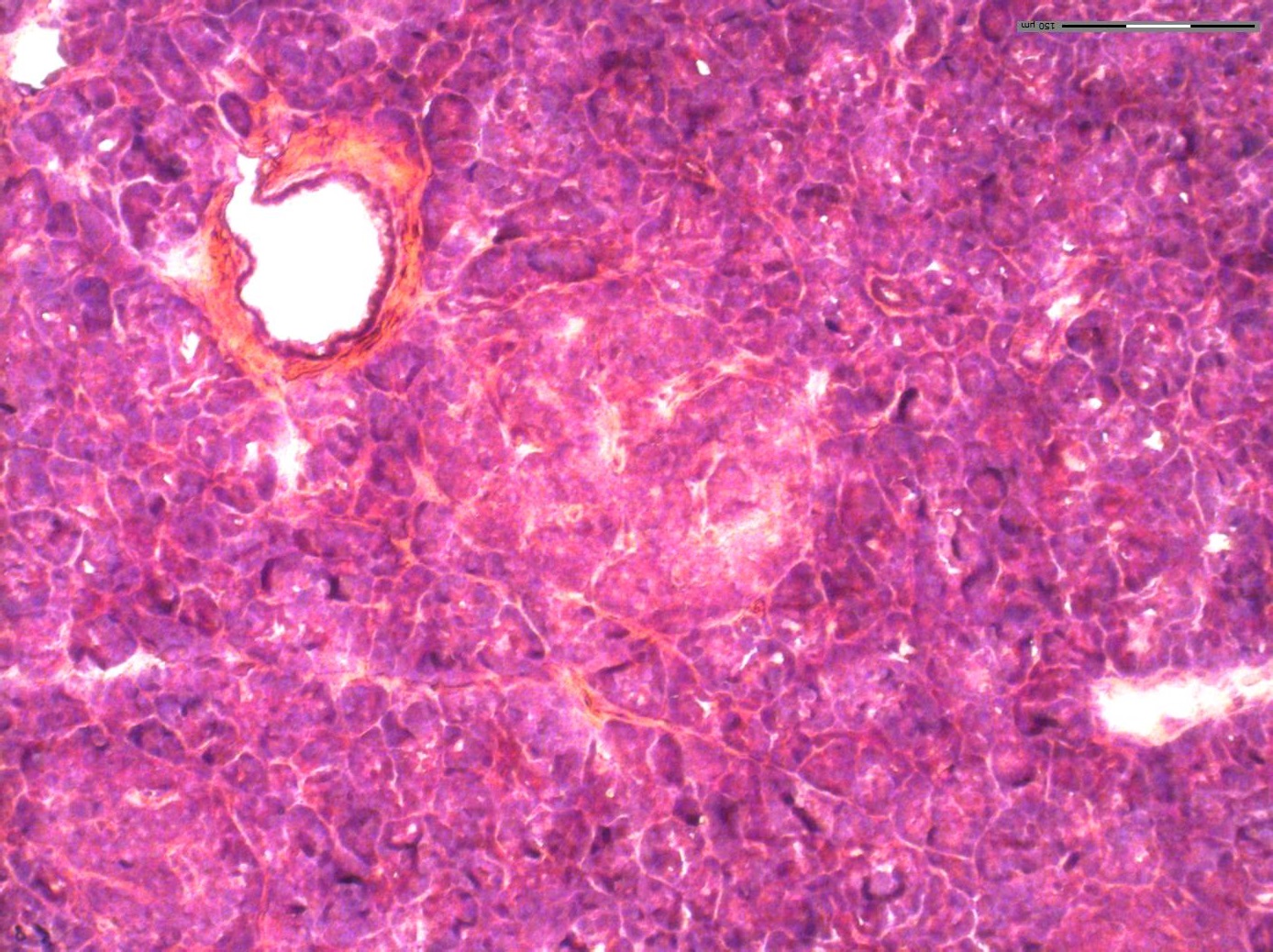 H&E stained pancreatic islet tissue at 10X magnification