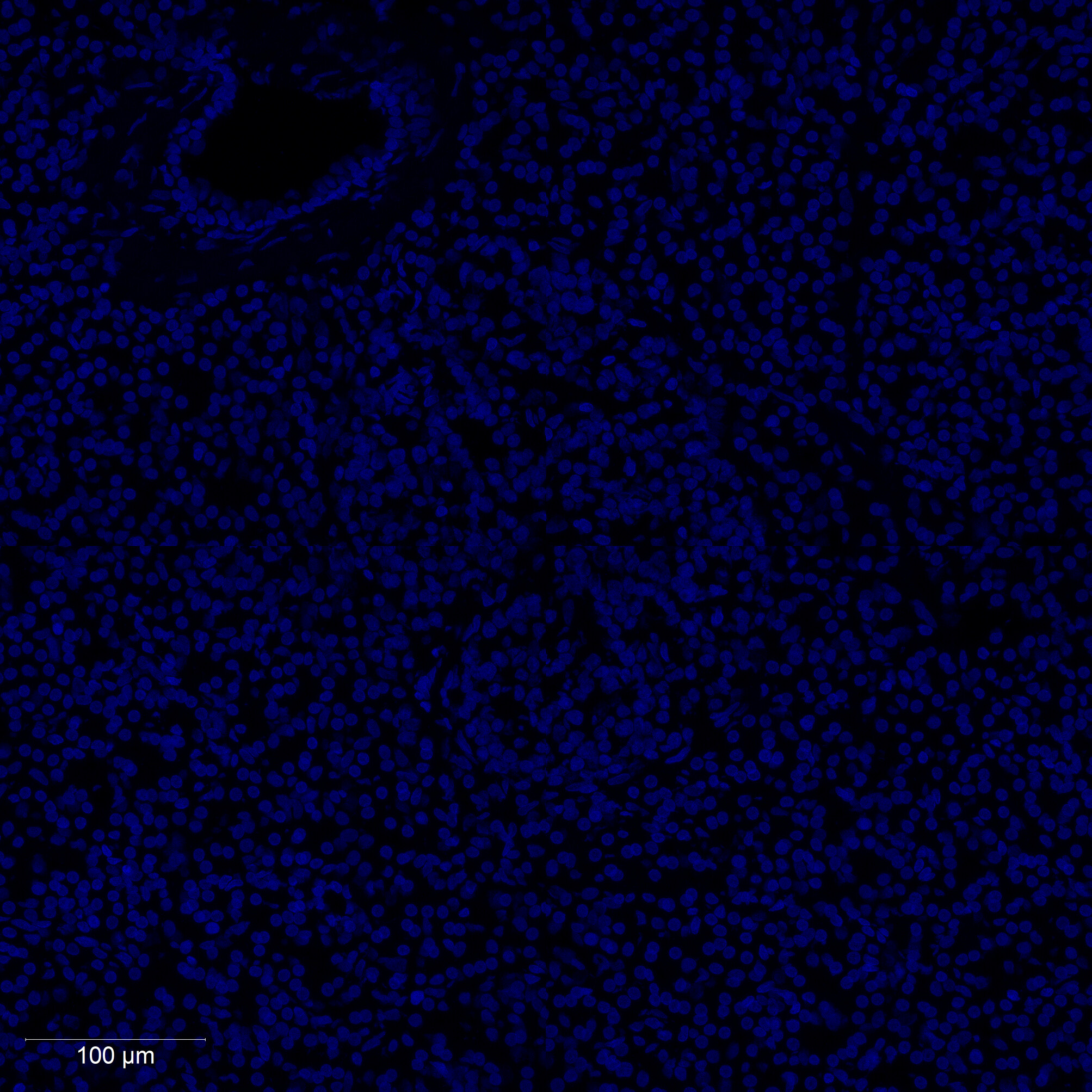 DAPI nuclear fluorescence